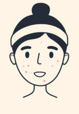جوش و آکنه